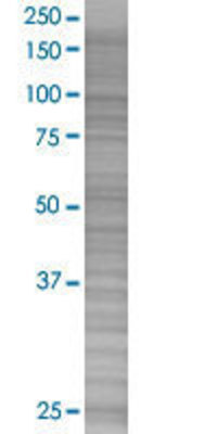 PIR transfected lysate.