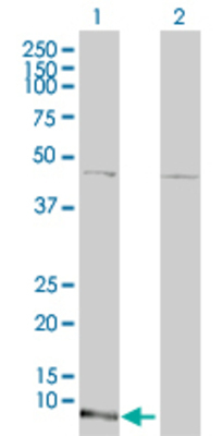 Lane 1: HOP transfected lysate (8.14 KDa). Lane 2: Non-transfected lysate.