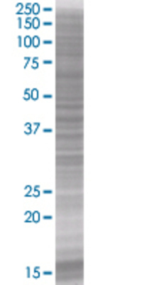 CD207 transfected lysate.