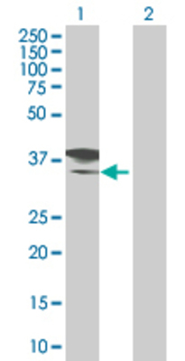 Lane 1: CD207 transfected lysate (36.19 KDa) Lane 2: Non-transfected lysate.