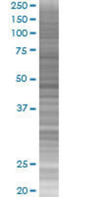 TFAP2D transfected lysate.