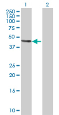 Lane 1: ATP4B transfected lysate (32.12 KDa) Lane 2: Non-transfected lysate.