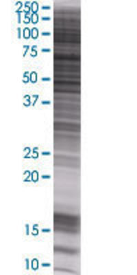ATP4B transfected lysate.