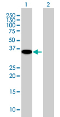 Lane 1: OGN transfected lysate (32.89 KDa). Lane 2: Non-transfected lysate.