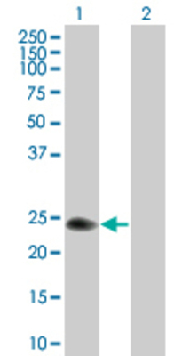Lane 1: BST2 transfected lysate (15.62 KDa) Lane 2: Non-transfected lysate.