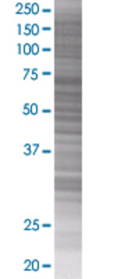 BTC transfected lysate.
