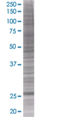 ARHGDIA transfected lysate