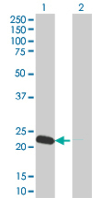 Lane 1: NME6 transfected lysate (21.45 KDa). Lane 2: Non-transfected lysate.