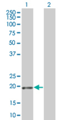 Lane 1: MGC2749 transfected lysate (19.47 KDa) Lane 2: Non-transfected lysate.