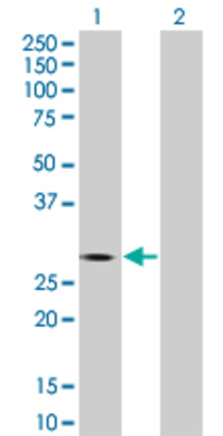 Lane 1: ARHGDIA transfected lysate (23.2 KDa). Lane 2: Non-transfected lysate.