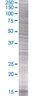 FTSJ1 transfected lysate