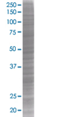 MDK transfected lysate
