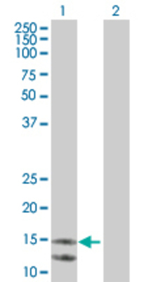 Lane 1: MDK transfected lysate (15.6 KDa). Lane 2: Non-transfected lysate.