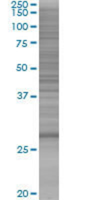 NQO1 transfected lysate.