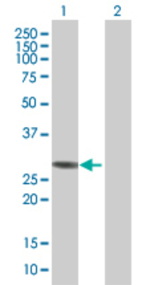 Lane 1: NQO1 transfected lysate (30.9 KDa) Lane 2: Non-transfected lysate.