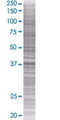 MAD2L1BP transfected lysate.