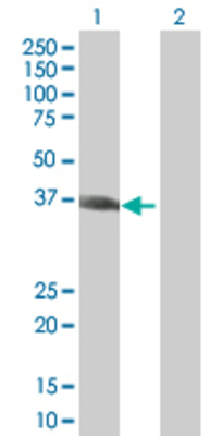Lane 1: MAD2L1BP transfected lysate (33.77 KDa) Lane 2: Non-transfected lysate.