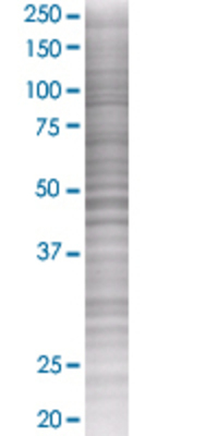 CD27 transfected lysate.