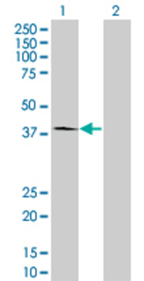 Lane 1: DNASE1 transfected lysate (31.4 KDa) Lane 2: Non-transfected lysate.