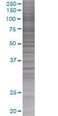 DNASE1 transfected lysate.