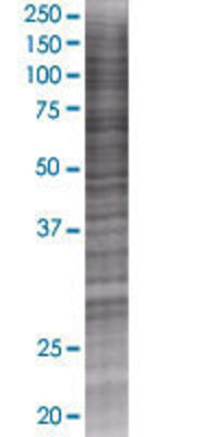 PCCA transfected lysate.