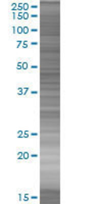 SERPINA5 transfected lysate.