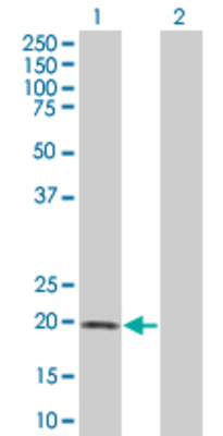 Lane 1: IL6 transfected lysate (23.7 KDa). Lane 2: Non-transfected lysate.