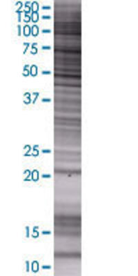 MGC4172 transfected lysate.