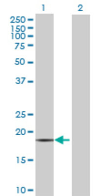 Lane 1: MGC4172 transfected lysate (20.02 KDa) Lane 2: Non-transfected lysate.