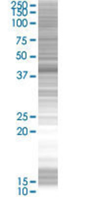 KRT19 transfected lysate.