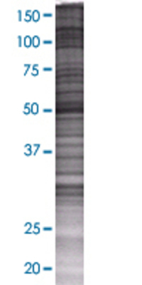 LAP3 transfected lysate.