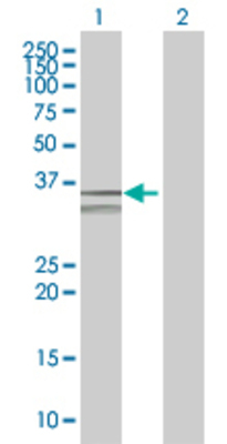 Lane 1: TXNDC transfected lysate (31.8 KDa) Lane 2: Non-transfected lysate.