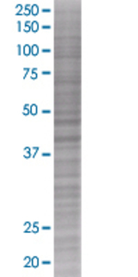 DHPS transfected lysate