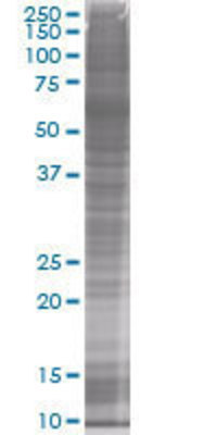 ELAVL3 transfected lysate