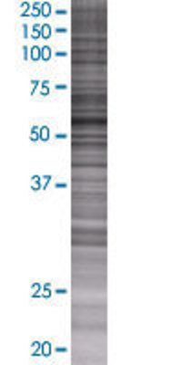 EPHX2 transfected lysate.