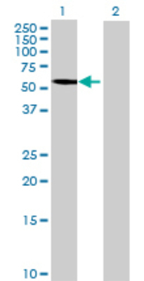 Lane 1: EPHX2 transfected lysate (61.16 KDa) Lane 2: Non-transfected lysate.