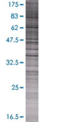 HEMK1 transfected lysate.