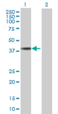 Lane 1: HEMK1 transfected lysate (37.29 KDa) Lane 2: Non-transfected lysate.