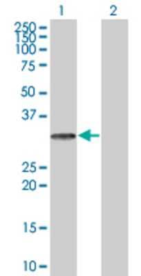 Lane 1: PROCR transfected lysate (26.29 KDa) Lane 2: Non-transfected lysate.