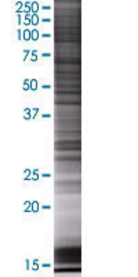 FKBP3 transfected lysate.