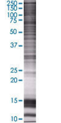ERCC5 transfected lysate.