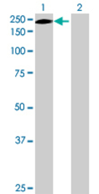Lane 1: ERCC5 transfected lysate (130.57 KDa) Lane 2: Non-transfected lysate.