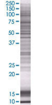 CCBL1 transfected lysate.