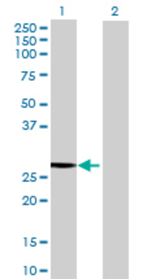 Lane 1: CCBL1 transfected lysate (27.61 KDa) Lane 2: Non-transfected lysate.