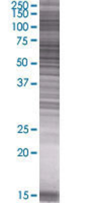 GLUD2 transfected lysate.