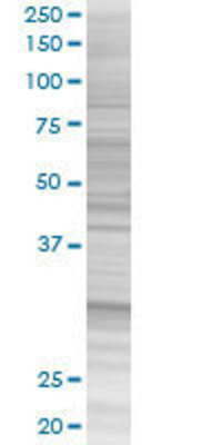 PPIE transfected lysate.