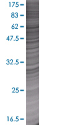 NUPL1 transfected lysate.