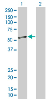 Lane 1: ENO2 transfected lysate (47.3 KDa). Lane 2: Non-transfected lysate.