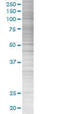 RNF133 transfected lysate.