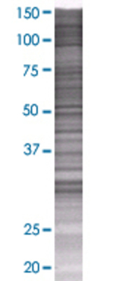 FLJ35220 transfected lysate.